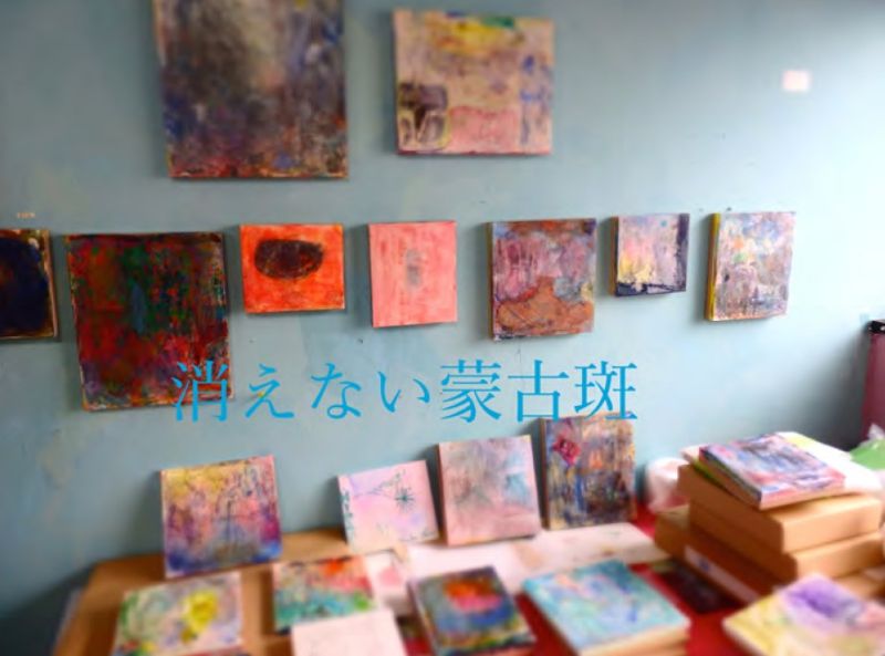梅津 庸一 「消えない蒙古斑」